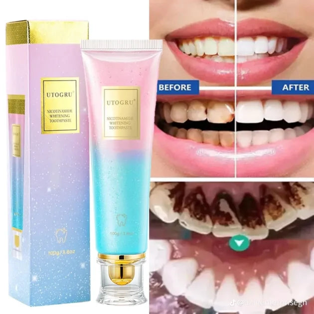 UTOGRU Whitening Toothpaste – Instant Bright Smile & Long-Lasting Fresh Breath