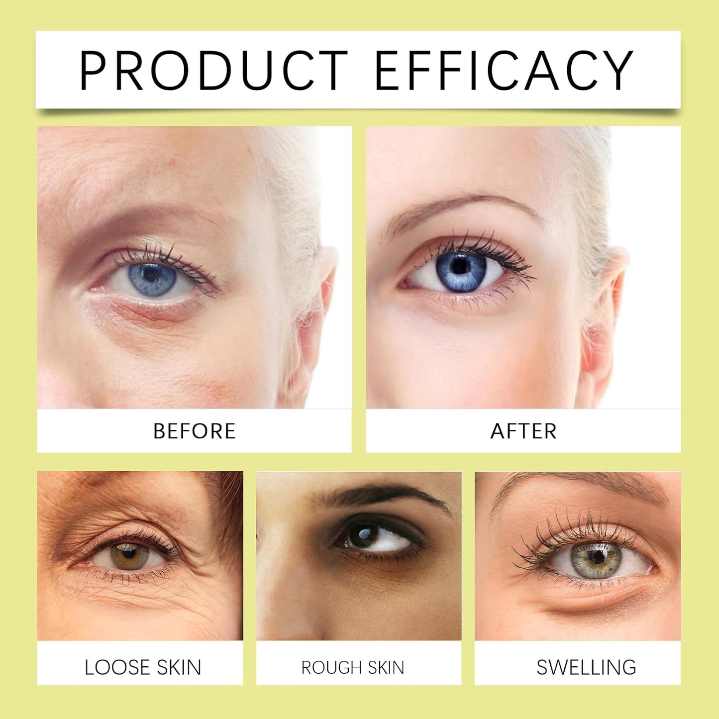 Celimax Vita A Retinal Shot Tightening Booster  – 0.1% Retinal & 3% Matrixyl Anti-Aging Serum for Wrinkles, Pore Minimizer, Firmer & Smoother Skin